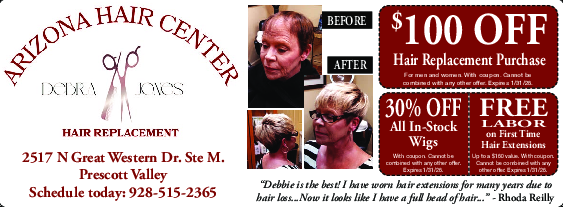 Coupon Offer: $100 OFF Hair Replacement Purchase