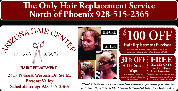 Coupon Offer: $100 OFF Hair Replacement Purchase