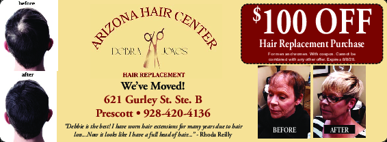 Coupon Offer: $100 OFF Hair Replacement Purchase
